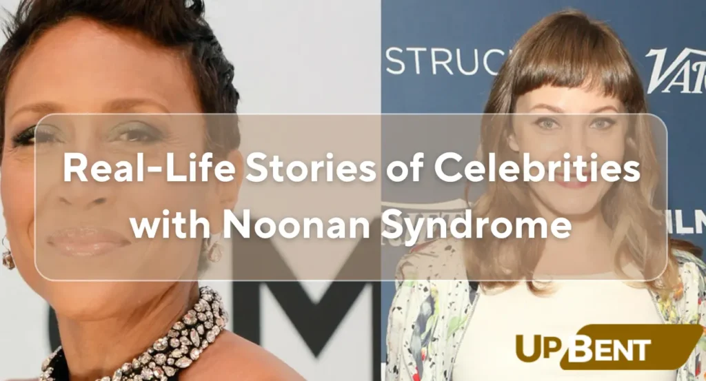 Real-Life Stories of Celebrities with Noonan Syndrome